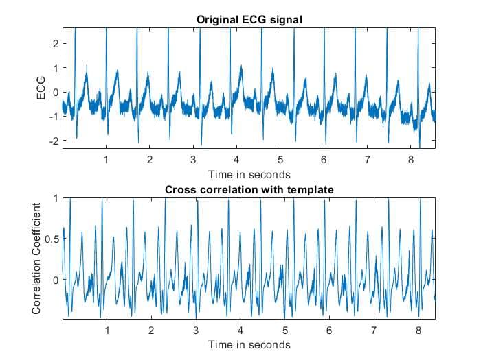 ECG Signal Denoising with Wiener Filtering evidence image 2