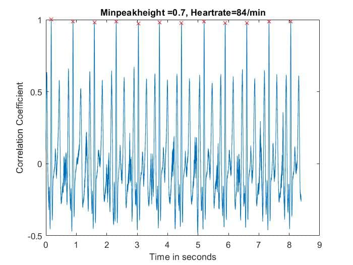 ECG Signal Denoising with Wiener Filtering evidence image 3